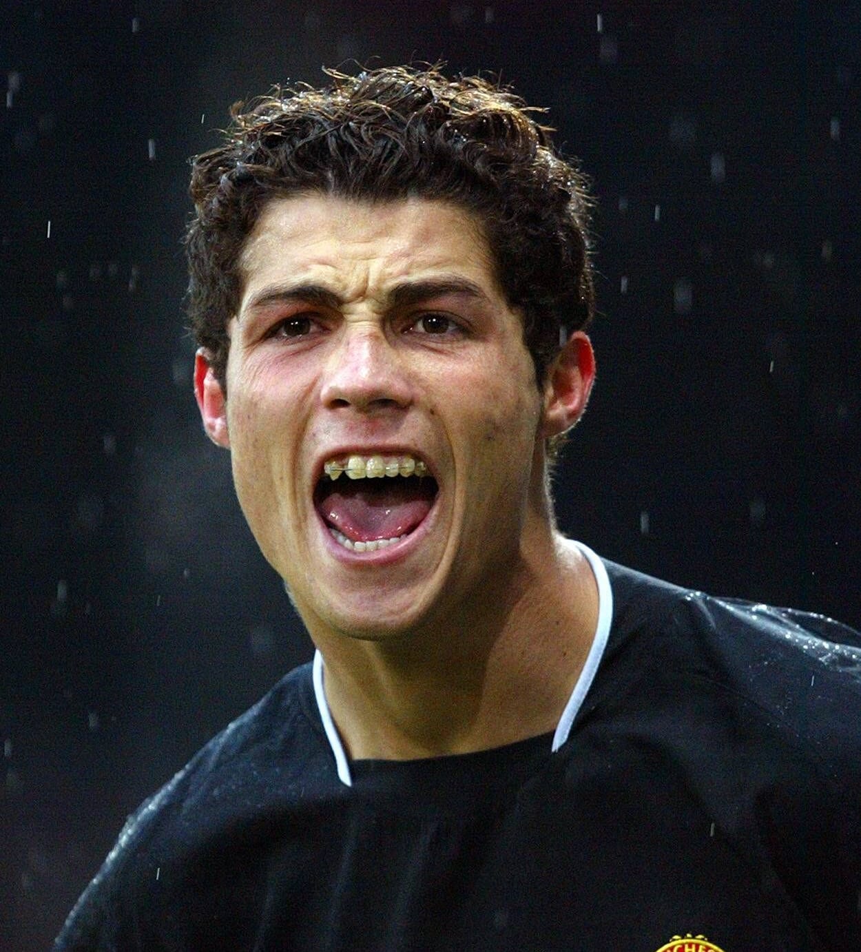 In der Spielzeit 2004/05 bei Manchester United trug Ronaldo Zahnspange.