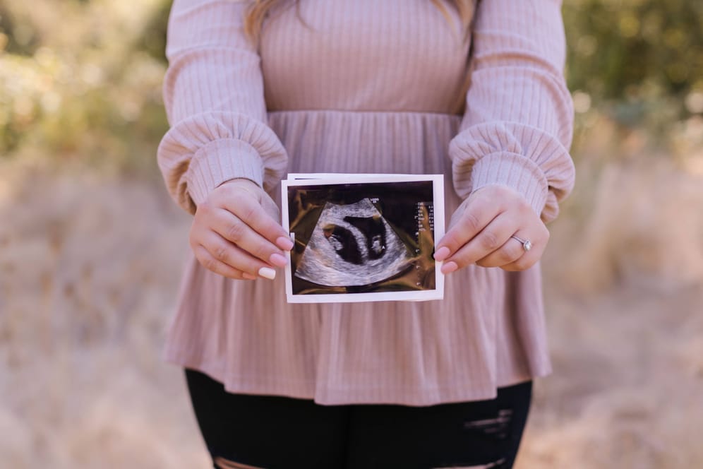 Eine schwangere Frau hält ein Ultraschallbild vor ihren Bauch (Archivbild): Wie werden ihre Kinder wohl heißen?