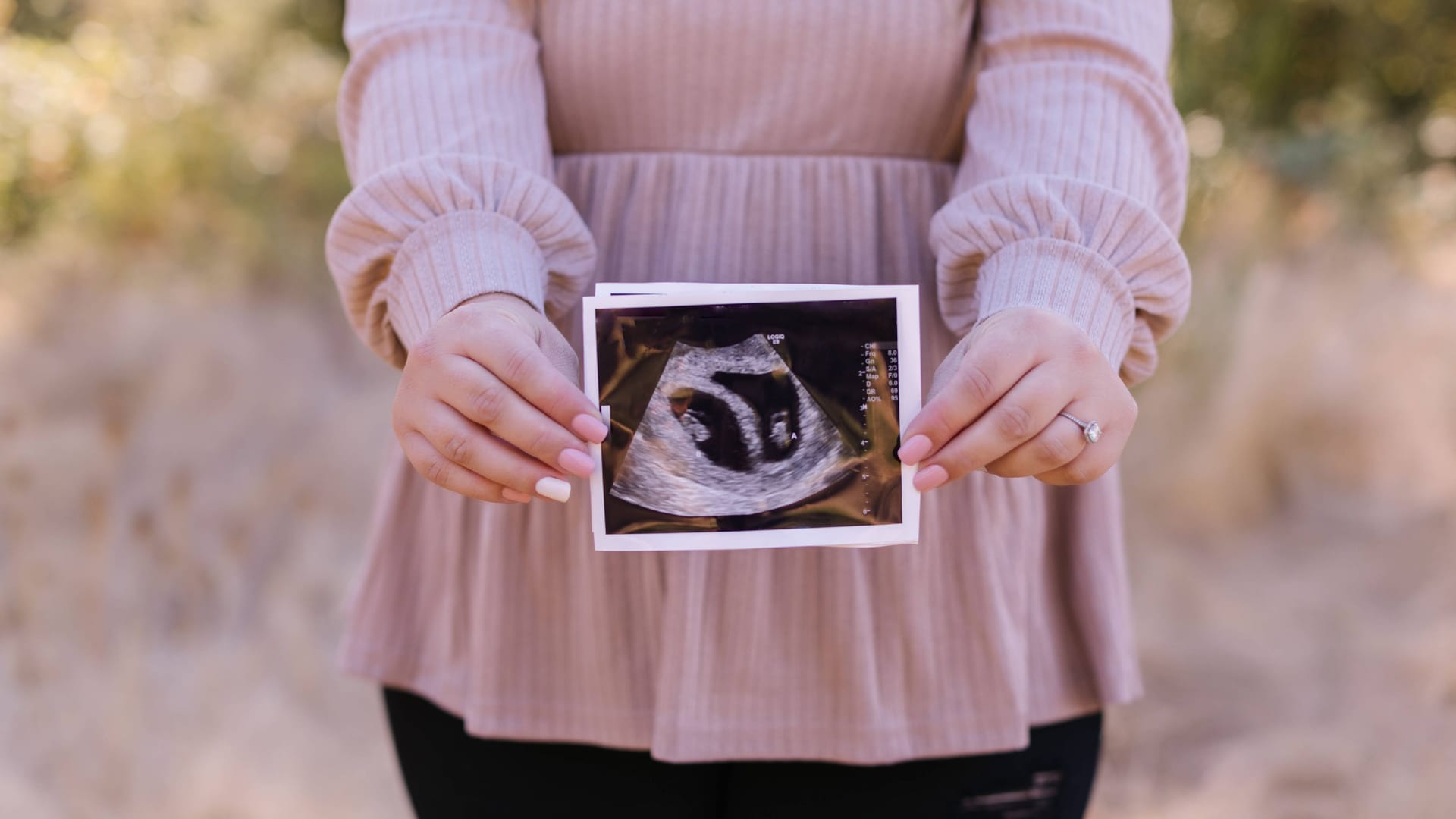 Eine schwangere Frau hält ein Ultraschallbild vor ihren Bauch (Archivbild): Wie werden ihre Kinder wohl heißen?