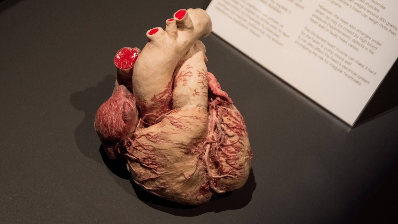 Herz in einer Ausstellung (Symbolbild): Eine Frau in England kann ihr echtes Herz im Museum besuchen.