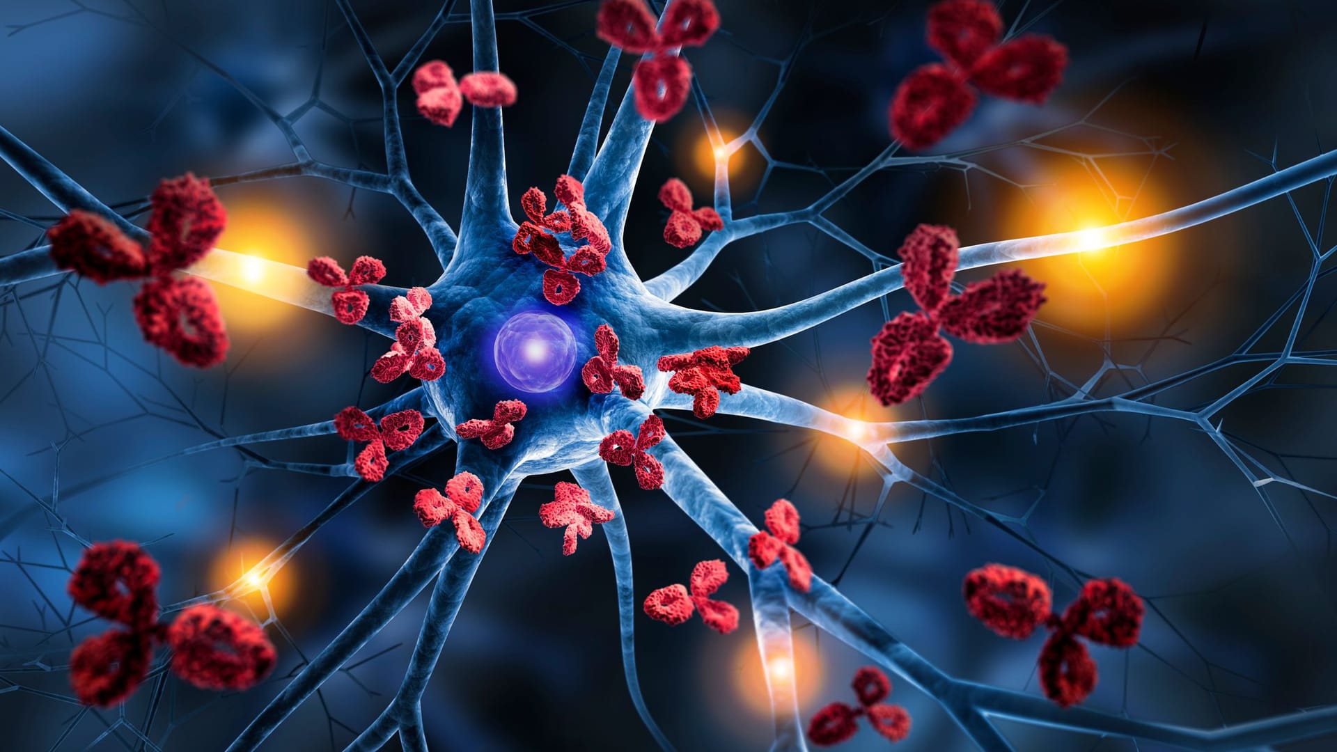 Bei der Multiplen Sklerose greift das Immunsystem fälschlicherweise eigene Körperzellen an. Dabei werden die Nervenzellen im Gehirn und im Rückenmark zerstört.