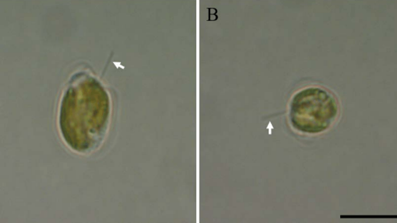 Lichtmikroskopische Aufnahmen zweier Zellen von Prymnesium Parvum: Die Alge verursachte das Fischsterben.