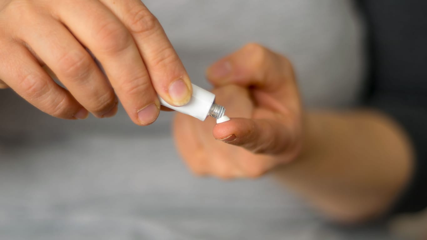 Eine Person drückt Creme aus einer Tube auf die Fingerspitze