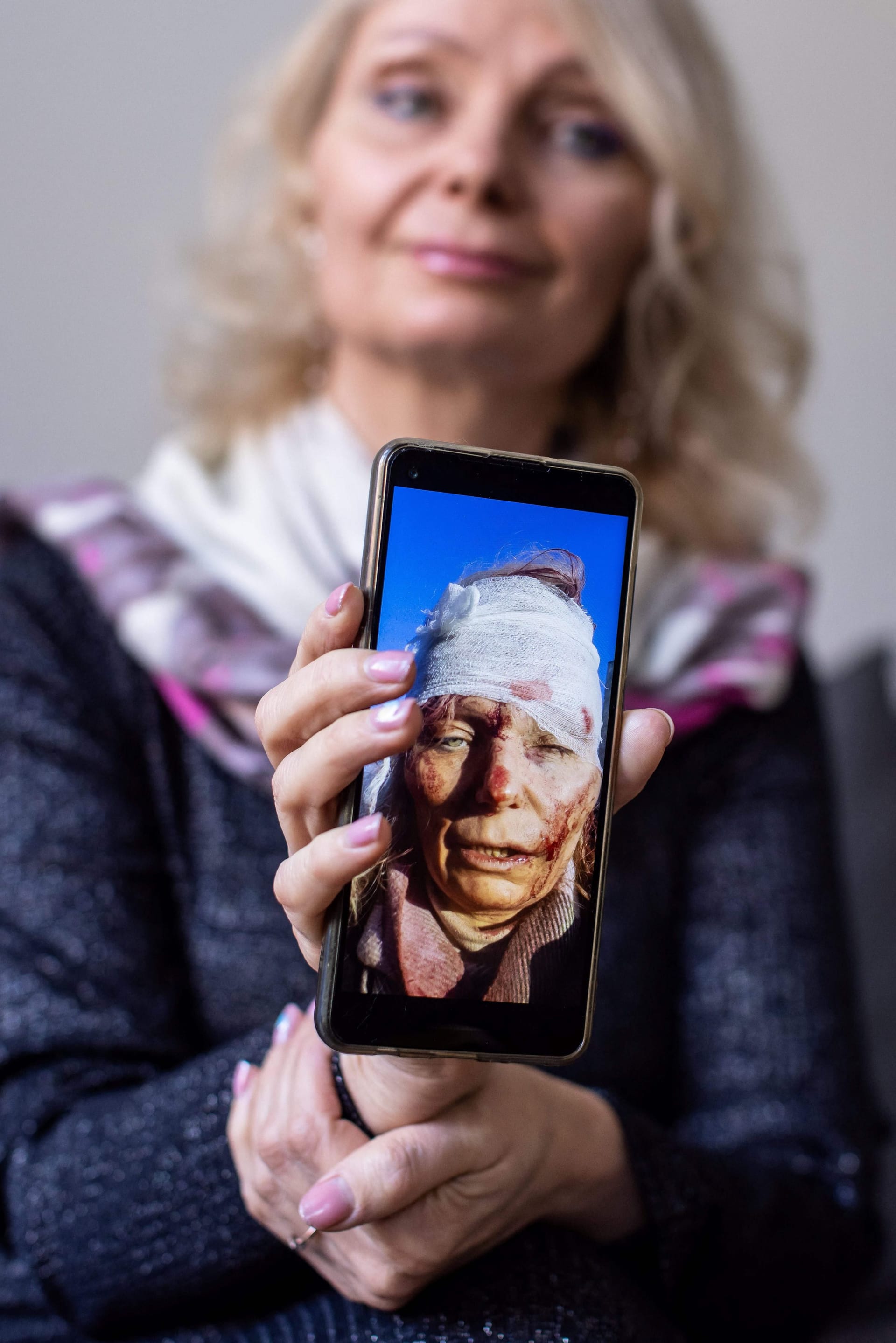 Olena Kurylo zeigt ein Foto auf ihrem Handy: Durch den russischen Angriff steckte ihr ein Splitter im Kopf.