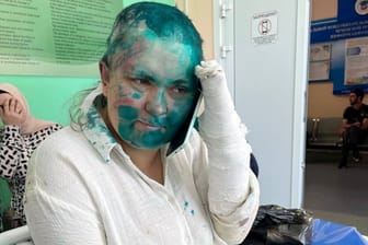 Jelena Milaschina in einem Krankenhaus in Grosny, nach der Attacke auf sie und einen Anwalt am 4. Juli 2023.