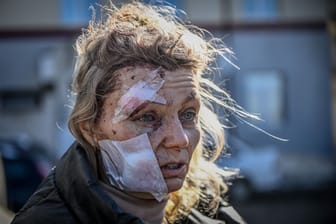 Olena Kurylo (Archivbild): Sie konnte in der Ukraine zunΓ€chst nur notdΓΌrftig versorgt werden. Olena Kurylo (Archivbild): Sie konnte in der Ukraine zunΓ€chst nur notdΓΌrftig versorgt werden.