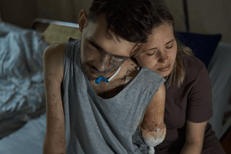 Andrii und Alina: Der Soldat wurde im Kampf schwer verwundet.