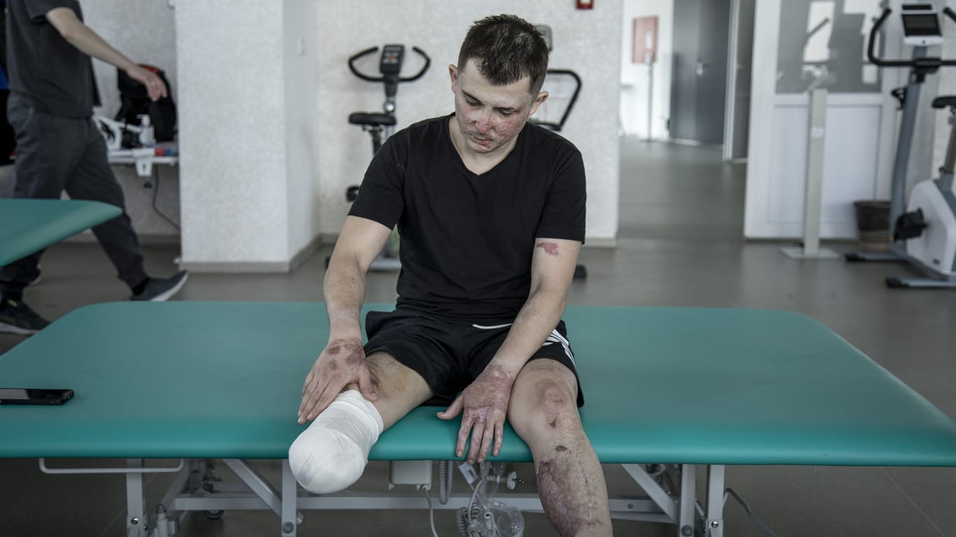 Illia Pylypenko war Soldat in der ukrainischen Armee. Als sein Panzer auf eine Mine fuhr riss ihm die Wucht der Explosion ein Bein ab und verletzte ihn am ganzen Körper schwer.