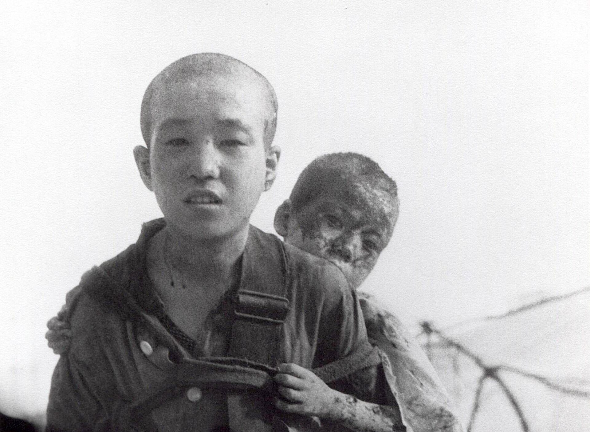 August 1945: Zwei Brüder, die den Atombombeneinschlag von Nagasaki überlebt haben.