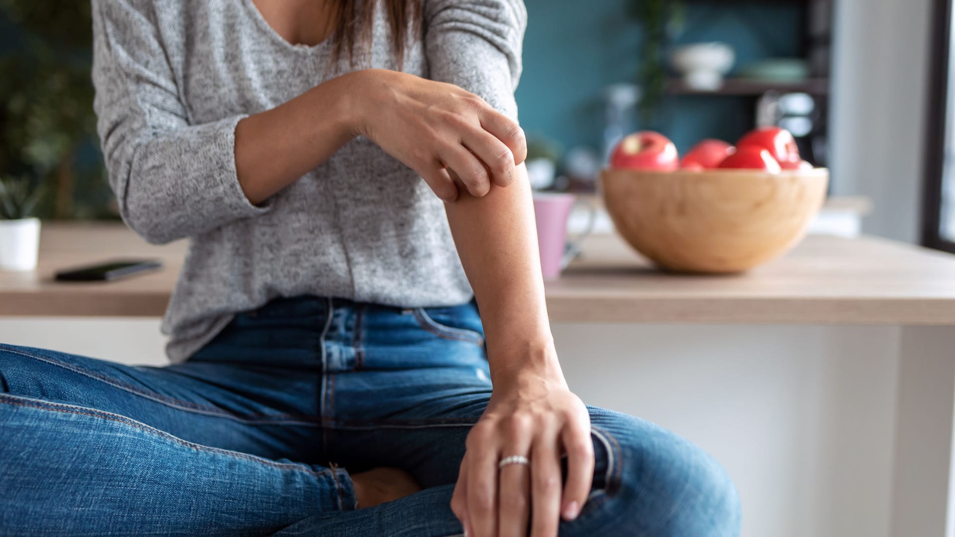 Frau kratzt sich am Arm: Nicht immer juckt ein Zeckenstich. Ist Juckreiz an der Einstichstelle ein Grund zur Besorgnis?