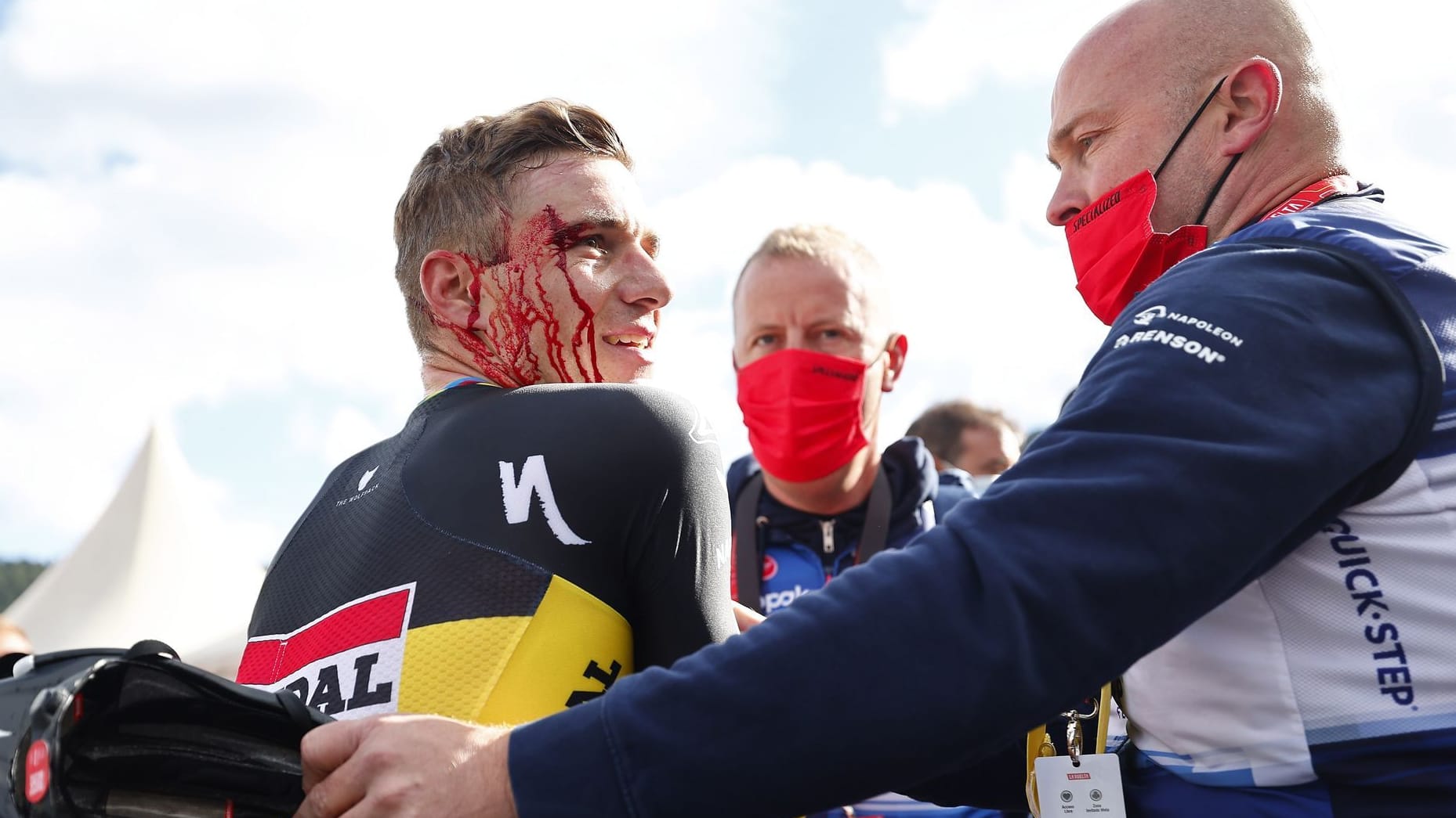 Remco Evenepoel mit blutiger Platzwunde: Die Zieleinfahrt wurde für den Radsport-Star zu einem schmerzhaften Erlebnis.