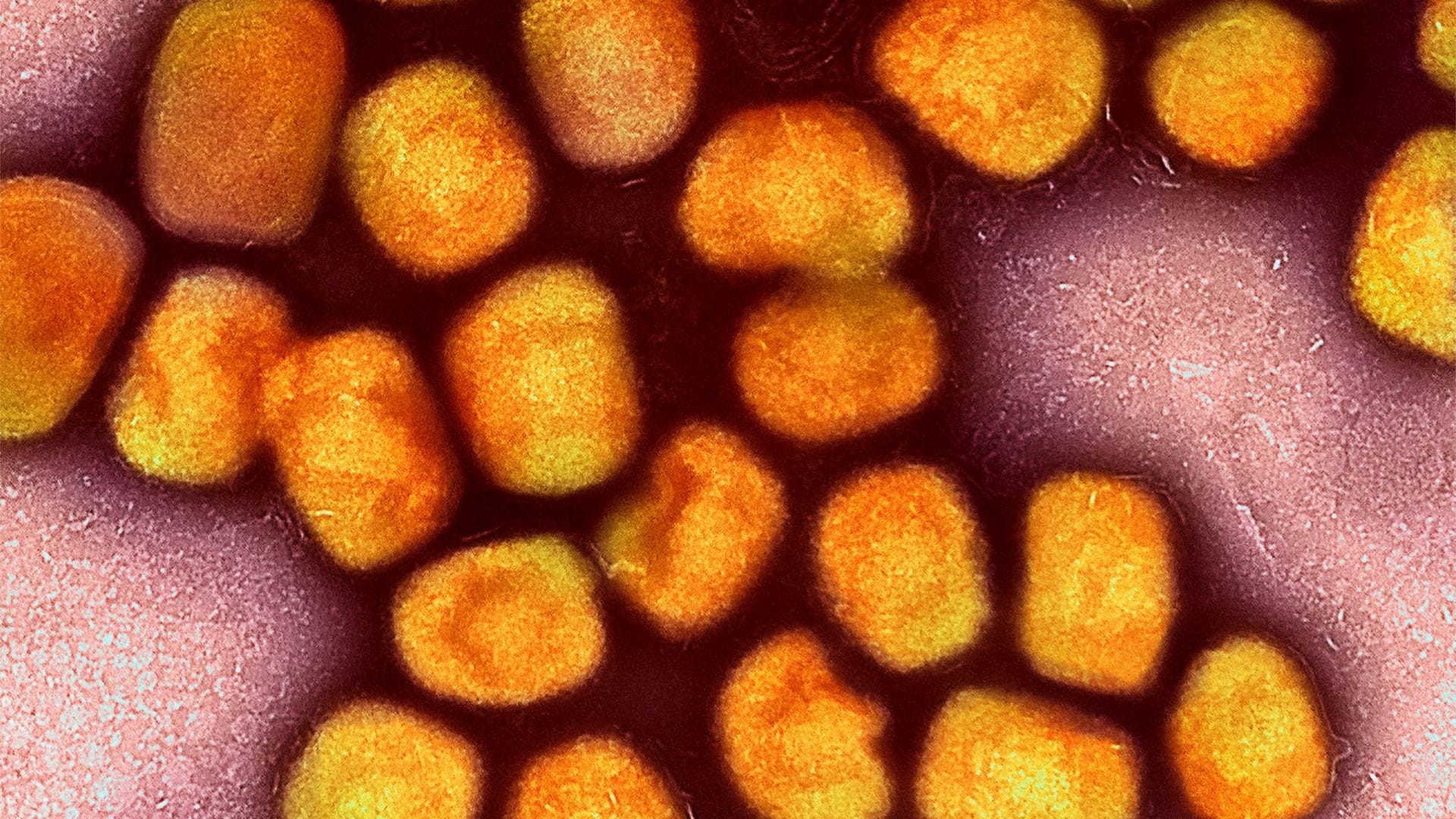 Nach mehr als einem halben Jahr ohne Nachweise von Mpox (früher Affenpocken) sind in Berlin und damit in Deutschland wieder einzelne Infektionen mit dem Virus bestätigt worden. Nach mehr als einem halben Jahr ohne Nachweise von Mpox (früher Affenpocken) sind in Berlin und damit in Deutschland wieder einzelne Infektionen mit dem Virus bestätigt worden.