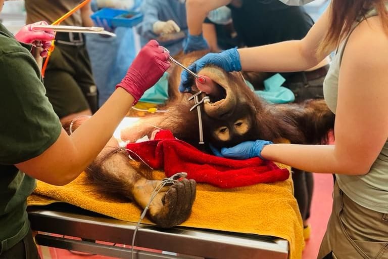 Der Eingriff: Cinta litt unter einer Eierstockinfektion.
