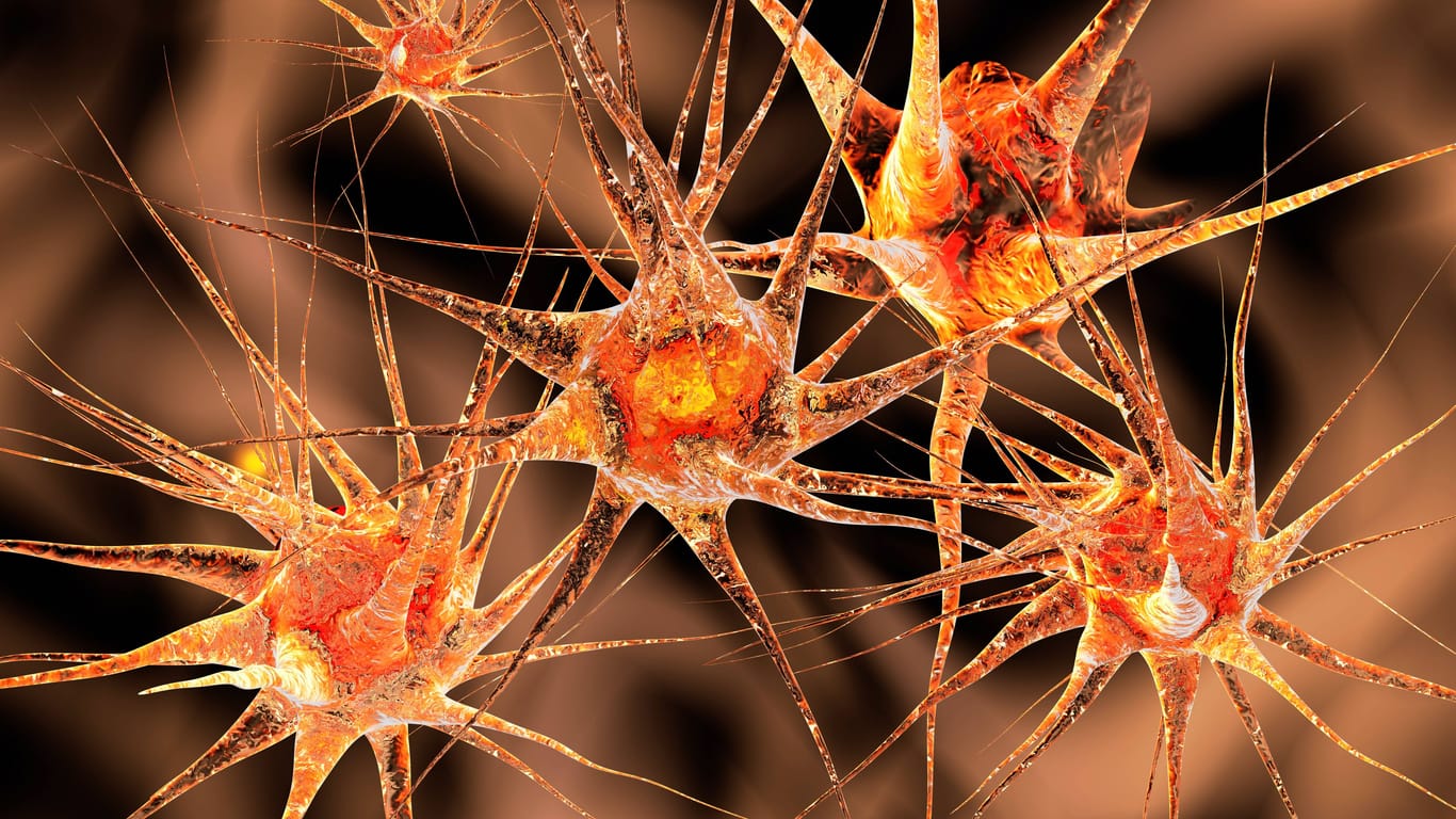 Nervenzellen: Altersbedingt kann sich das Nervengewebe im Hirn entzünden.