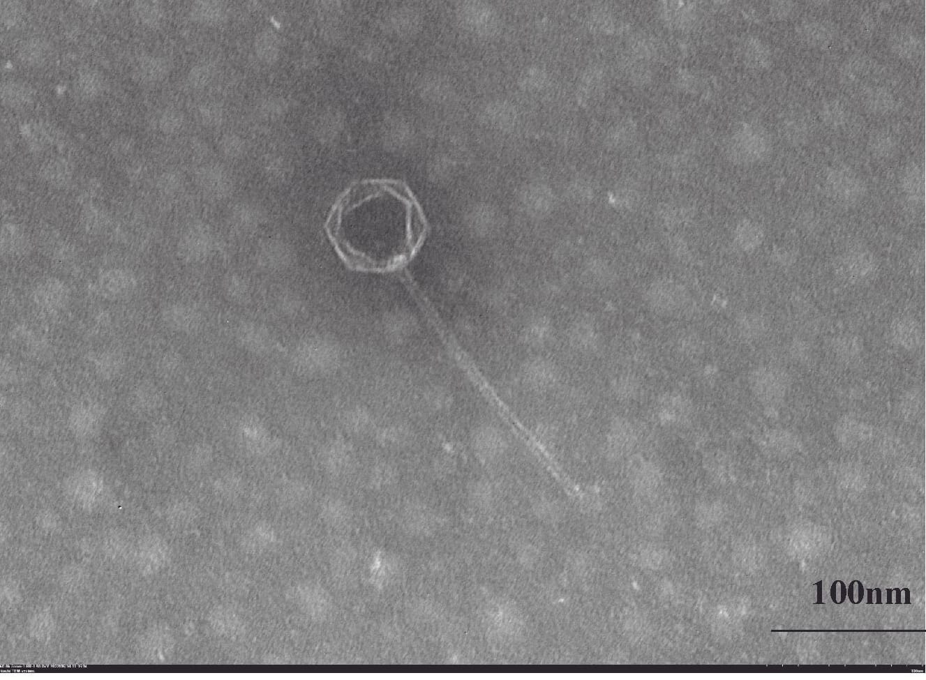 Eine Aufnahme der Bakteriophage unter dem Mikroskop.
