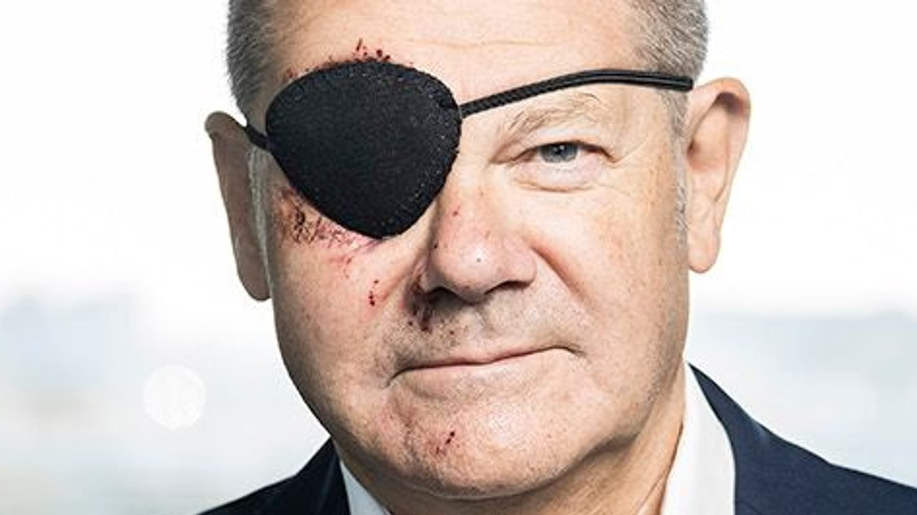 Chancellor shows up after a fall with an eye patch - News Directory 3