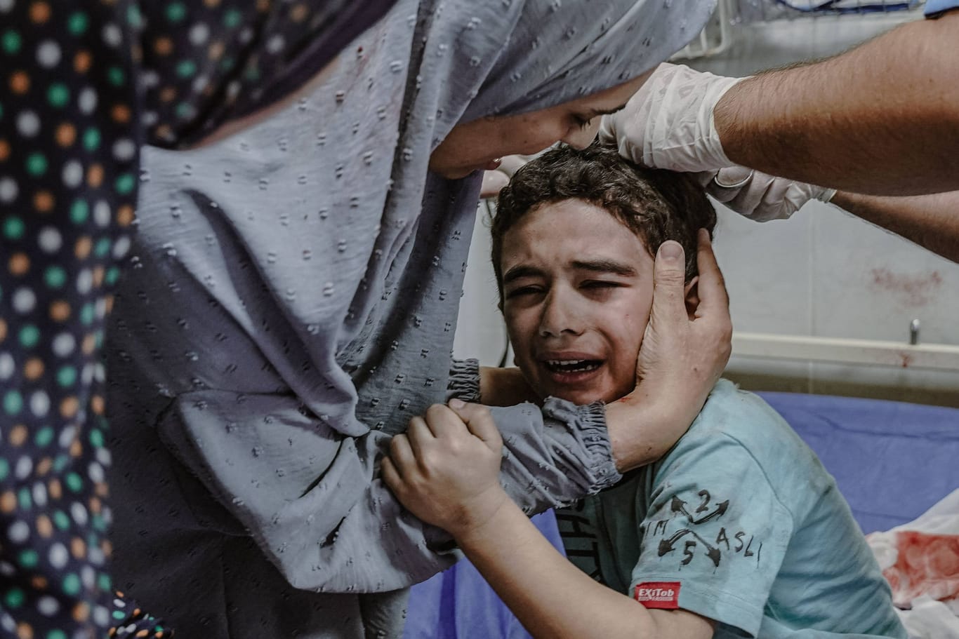 Ein verletztes Kind wird nach einem israelischen Angriff auf den Gazastreifen im Hospital versorgt.