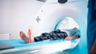 Eine Untersuchung in einem CT-Gerät (Symbolbild): In Russland wurde bei einer Frau eine Nadel im Gehirn entdeckt.
