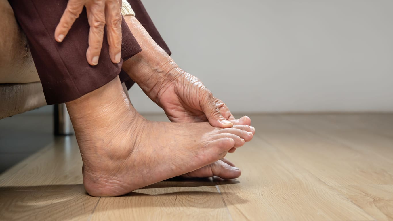 Thickly swollen feet: They are usually harmless, but can also indicate serious illnesses.