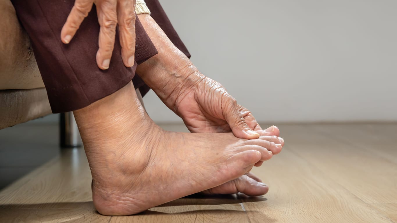 Dick angeschwollene Füße: Sie sind meist harmlos, können aber auch auf ernste Erkrankungen hinweisen.