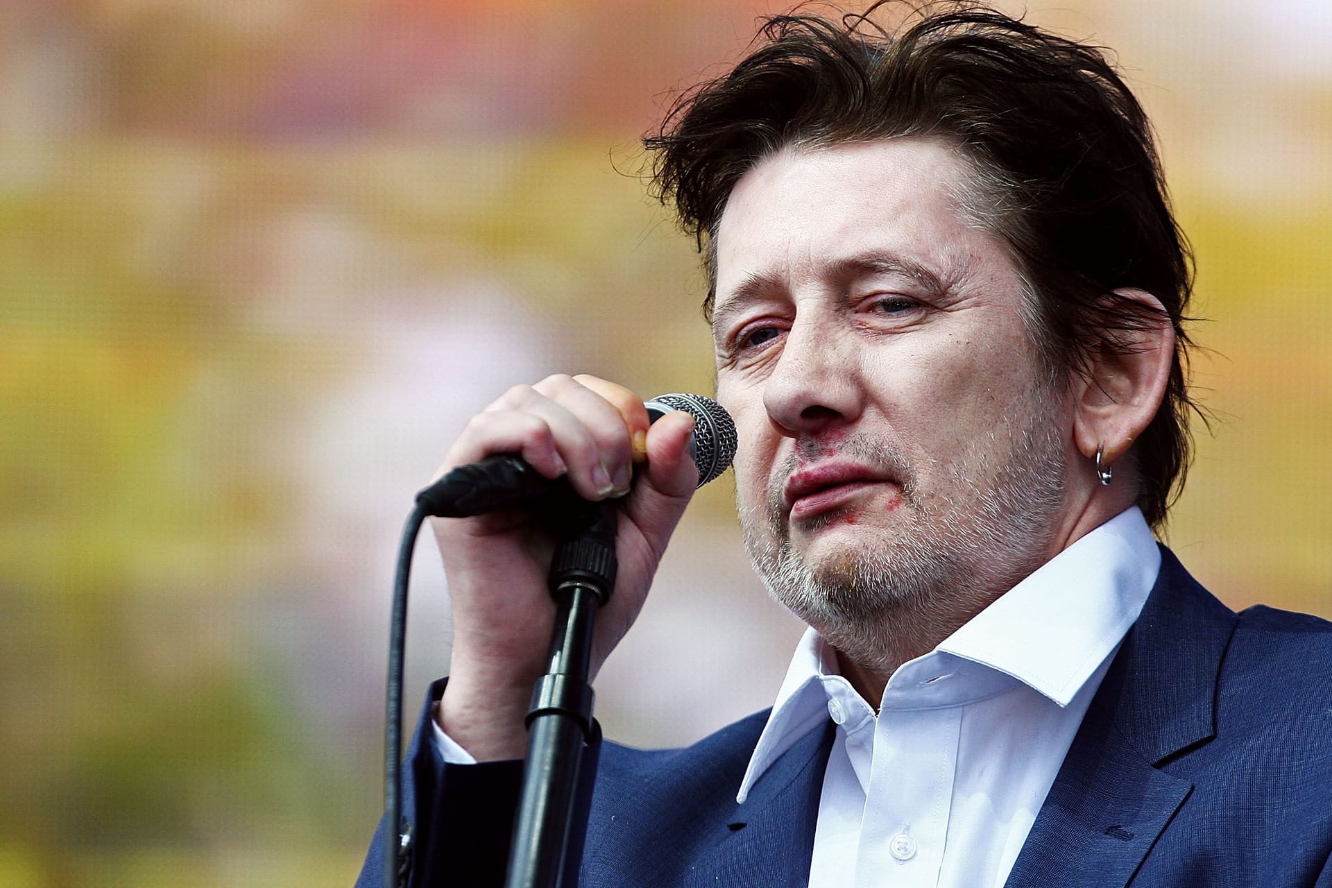 Shane MacGowan: Der irische Sänger starb im Alter von 65 Jahren.