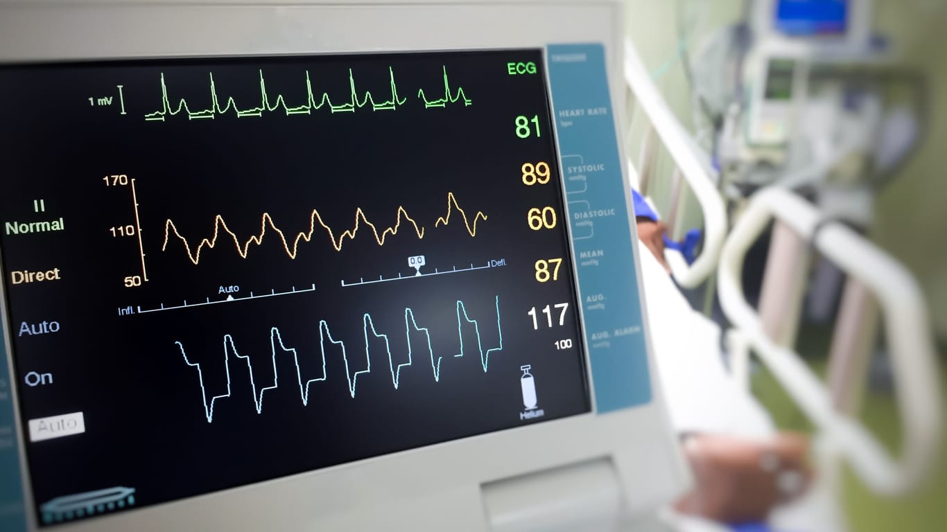 Ein Elektrokardiogramm (EKG) gibt Hinweise, ob das Herz unzureichend mit Sauerstoff versorgt ist und möglicherweise Gefäßschäden vorliegen.