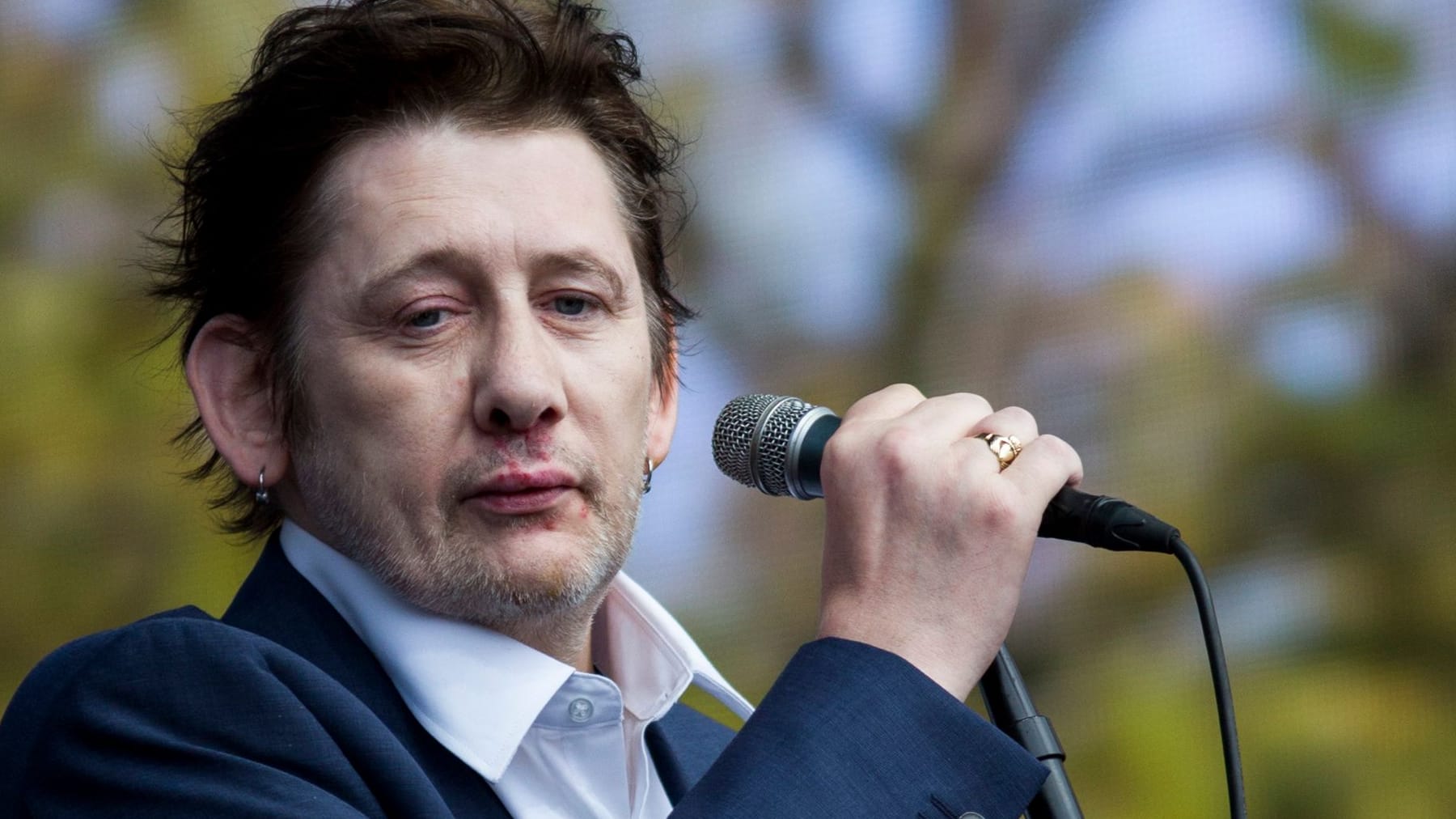 Shane MacGowan starb mit 65 Ehefrau bestätigt Todesursache