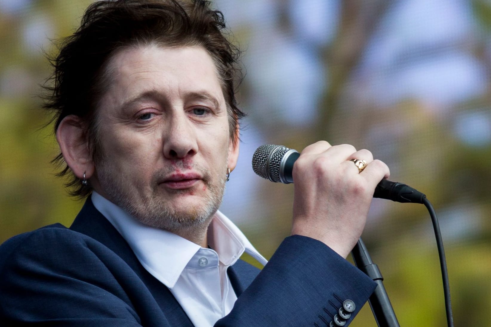 Shane MacGowan: Der Sänger kämpfte in der Vergangenheit mit gesundheitlichen Problemen.