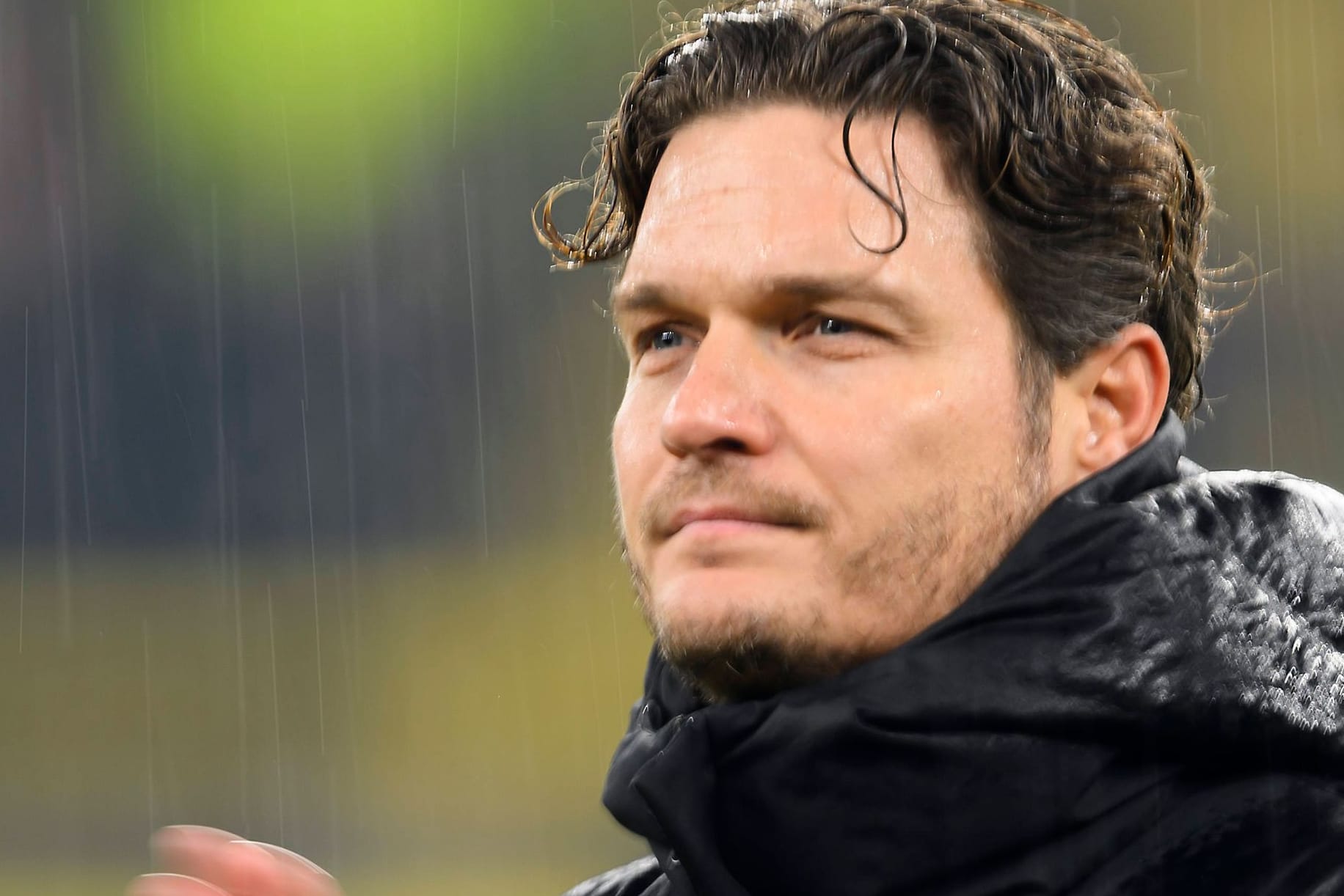 Edin Terzić: Angesichts der Ergebniskrise des BVB gerät auch er unter Druck.