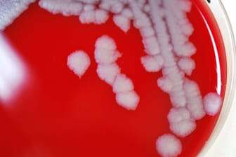In einer Petrischale wächst eine Kolonie von Anthrax-Bakterien (Bacillus anthracis).