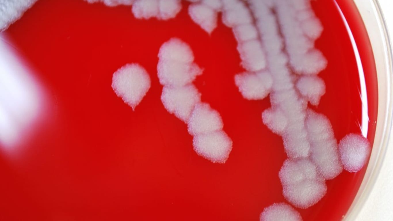 In einer Petrischale wächst eine Kolonie von Anthrax-Bakterien (Bacillus anthracis).