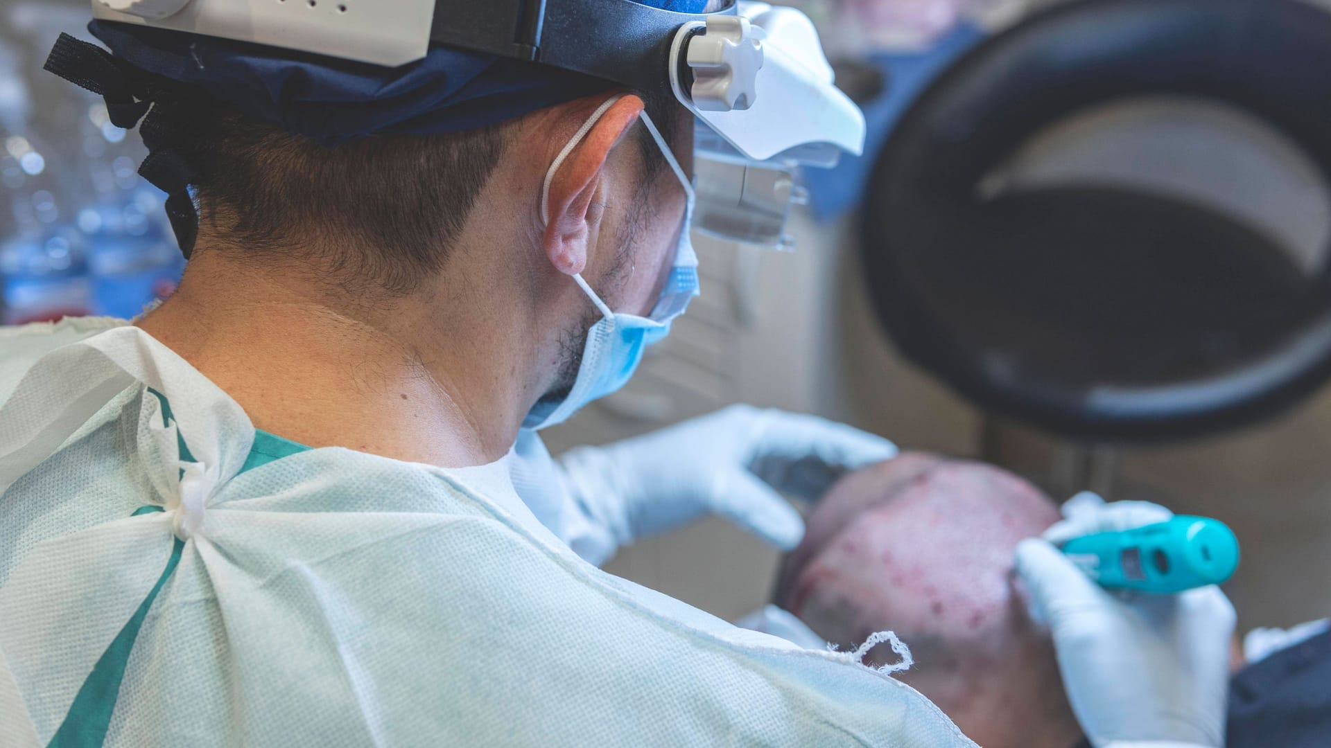 Ein Haartransplantation (Symbolbild): Über den Eingriff gibt es kaum neutrale Informationen im Netz.