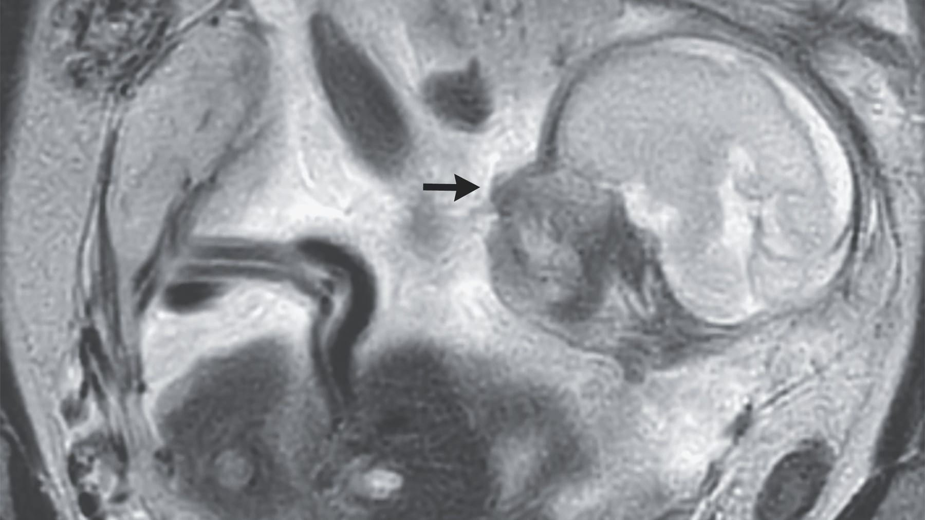 Ultraschallbild der Schwangerschaft: Der Arzt der Frau entschied sich, sie an ein Krankenhaus zu überweisen.