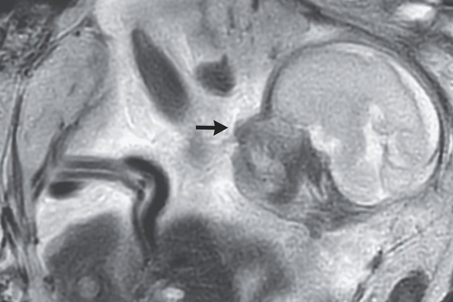 Ultraschallbild der Schwangerschaft: Der Arzt der Frau entschied sich, sie an ein Krankenhaus zu überweisen.