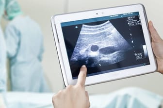 Tablet mit Ultraschallbild (Symbolbild): Eigentlich sind posthume Befruchtungen in Western Australia verboten.