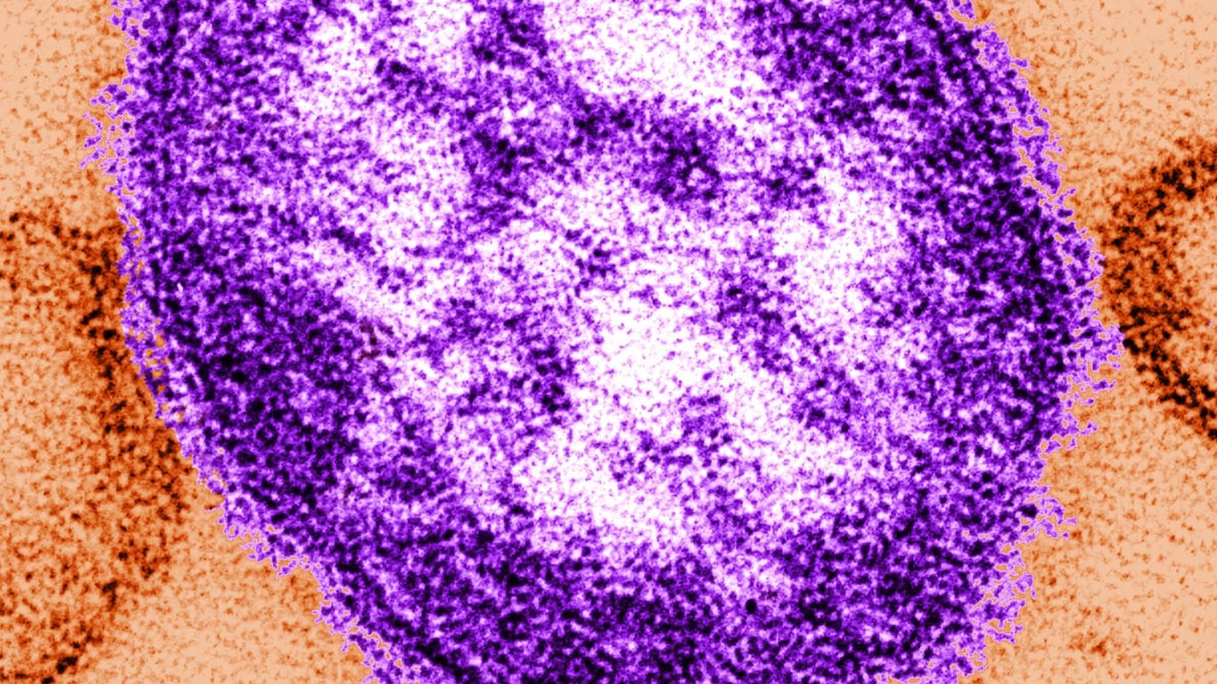 Das Masernvirus (Archivbild): So sieht es unter einem Transmissionselektronenmikroskop aus.
