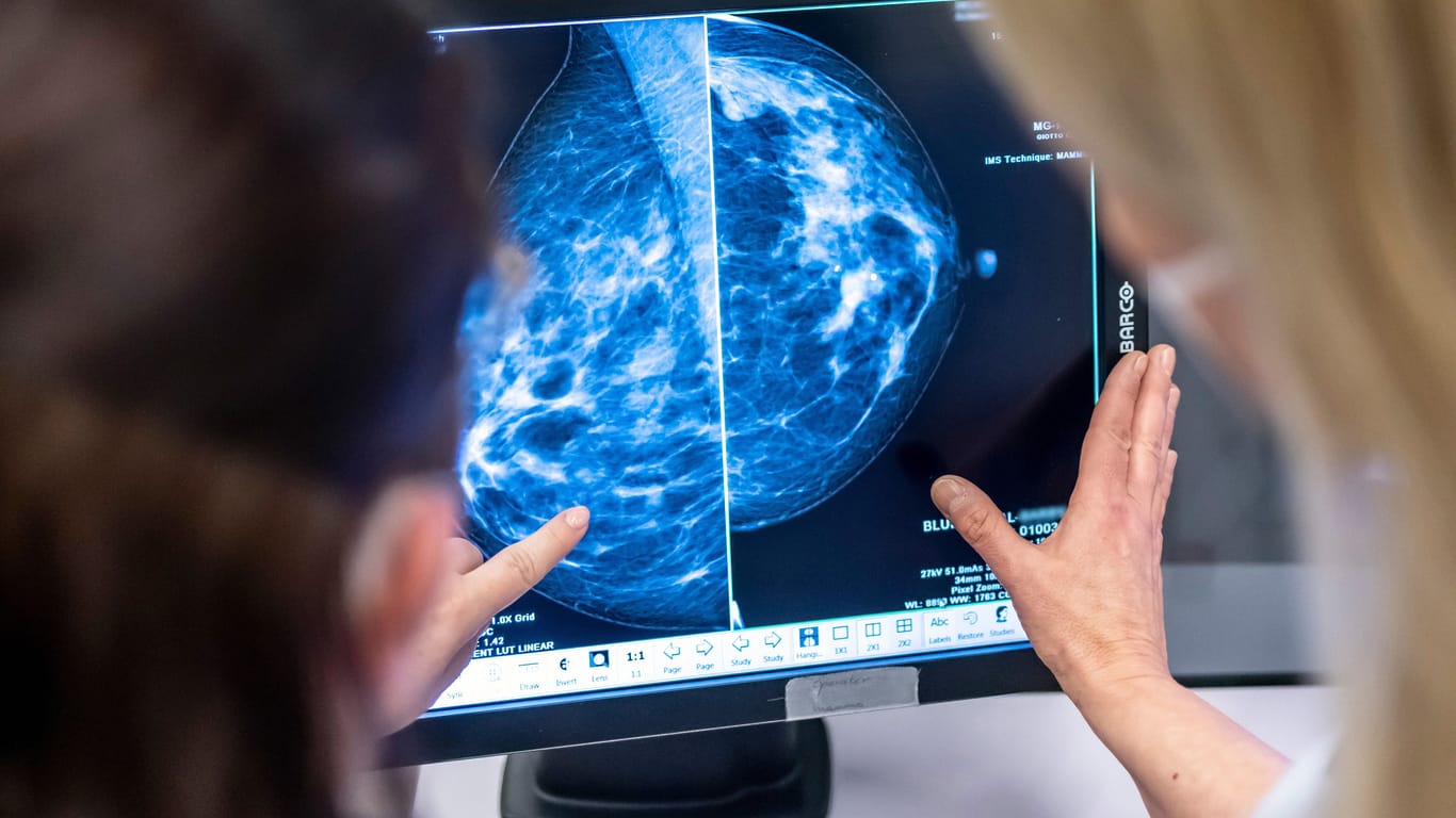 Mammographie: Bei der Vorsorgeuntersuchung wird die Brust einer Frau auf Brustkrebs untersucht.