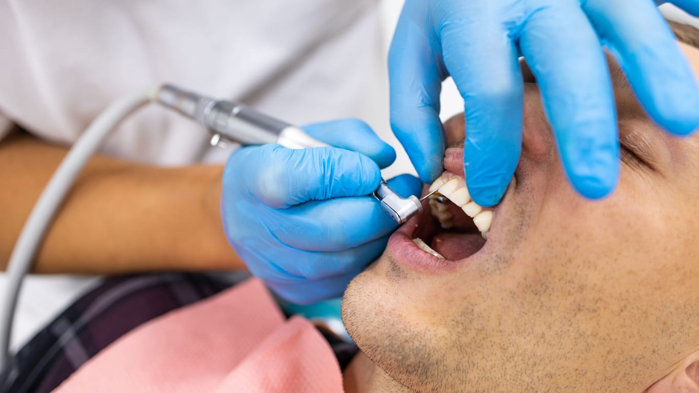 Lange erprobt: Amalgam dient seit Anfang des 19. Jahrhunderts als Zahnfüllstoff bei Karies.