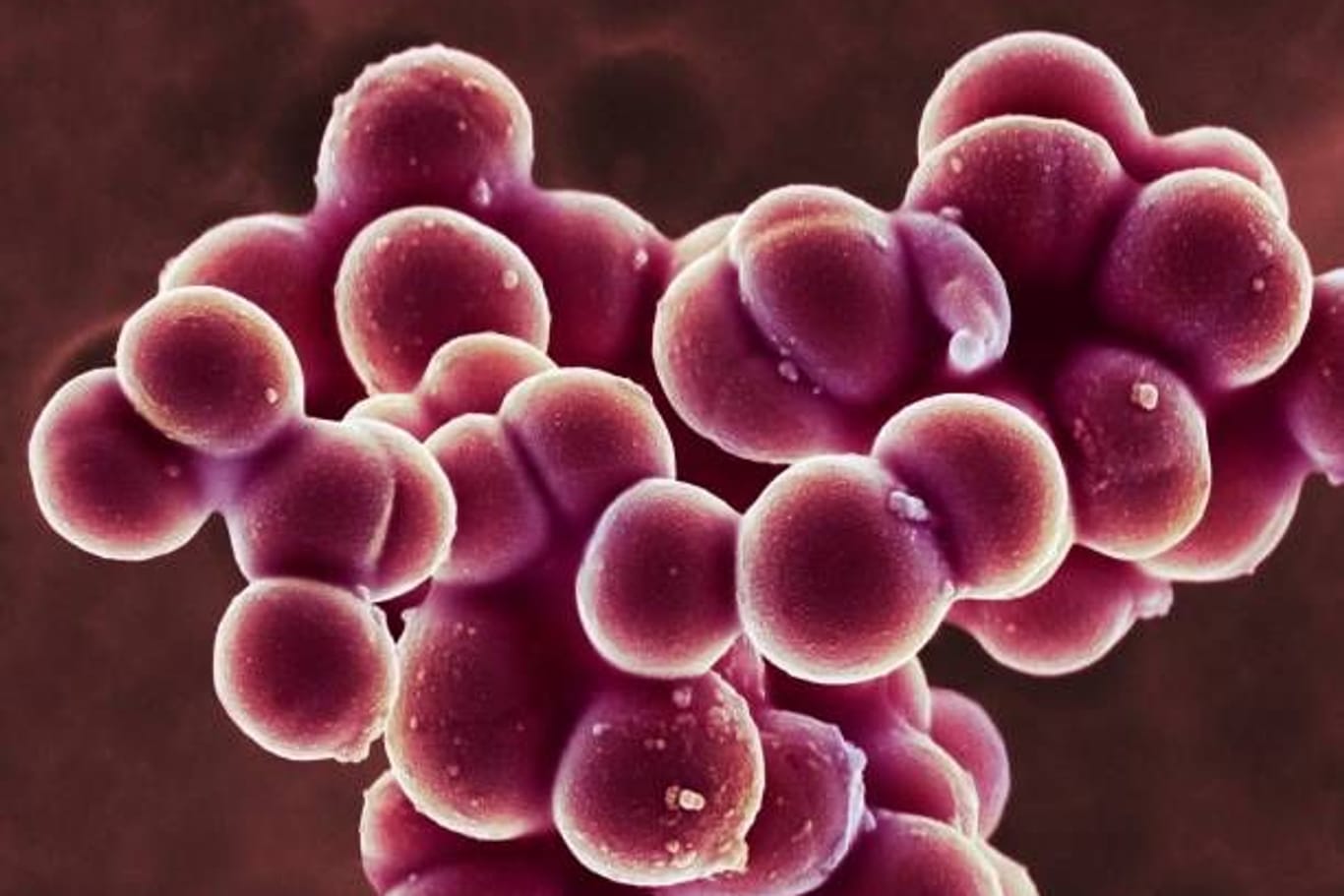 Staphylococcus aureus: Die kugelförmigen Bakterien gehören zu den häufigsten Erregern einer im Krankenhaus erworbenen Lungenentzündung.