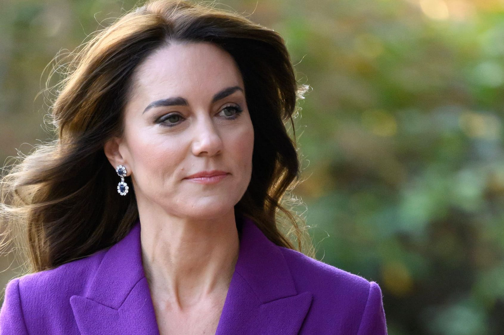 Prinzessin Kate: Sie erholt sich aktuell von einer Operation am Unterleib.