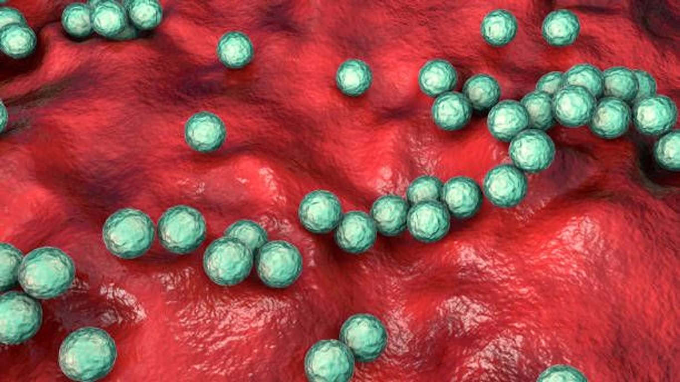 Abbildung von Streptokokken: Die Bakterien können schwere Entzündungen im Körper hervorrufen.