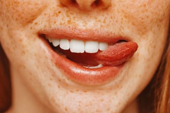 Gesunde Zähne: Apfelessig sollten Sie nicht zur Zahnpflege verwenden.