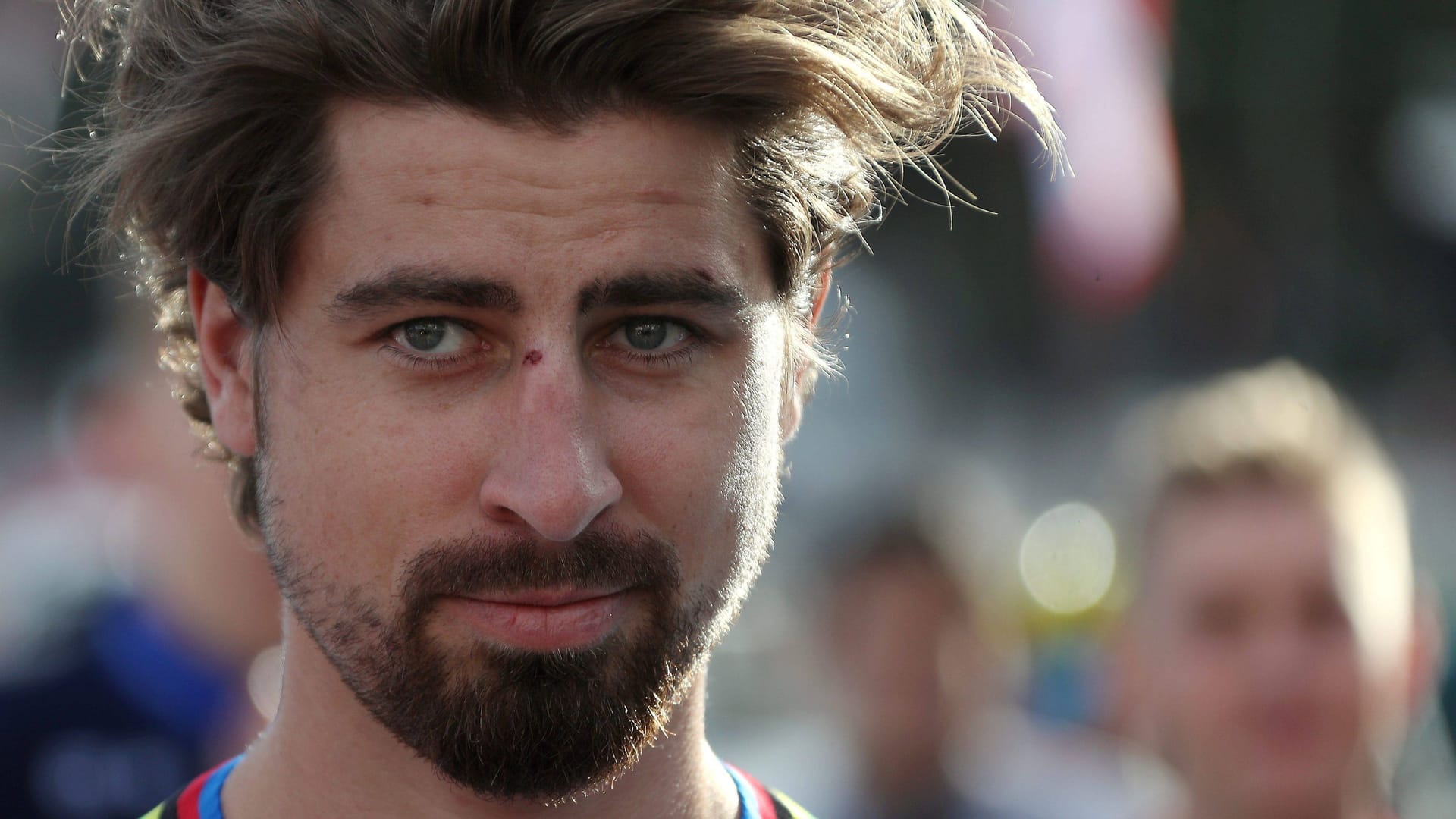 Peter Sagan: Der frühere Rad-Weltmeister muss am Herzen operiert werden.