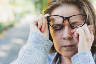Gerötete, tränende Augen: Eine sogenannte Augengrippe wird durch Viren hervorgerufen.