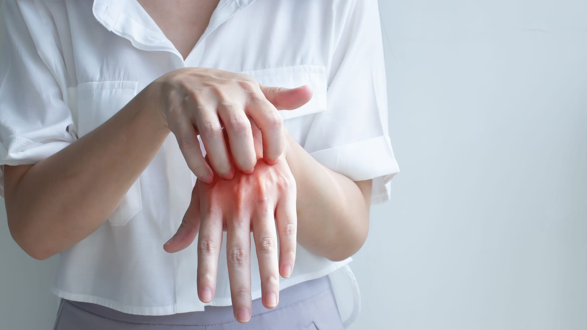 Eine Frau kratzt sich an der Hand