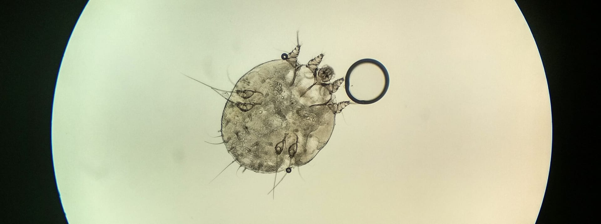 Mikroskopische Aufnahme einer Krätzmilbe