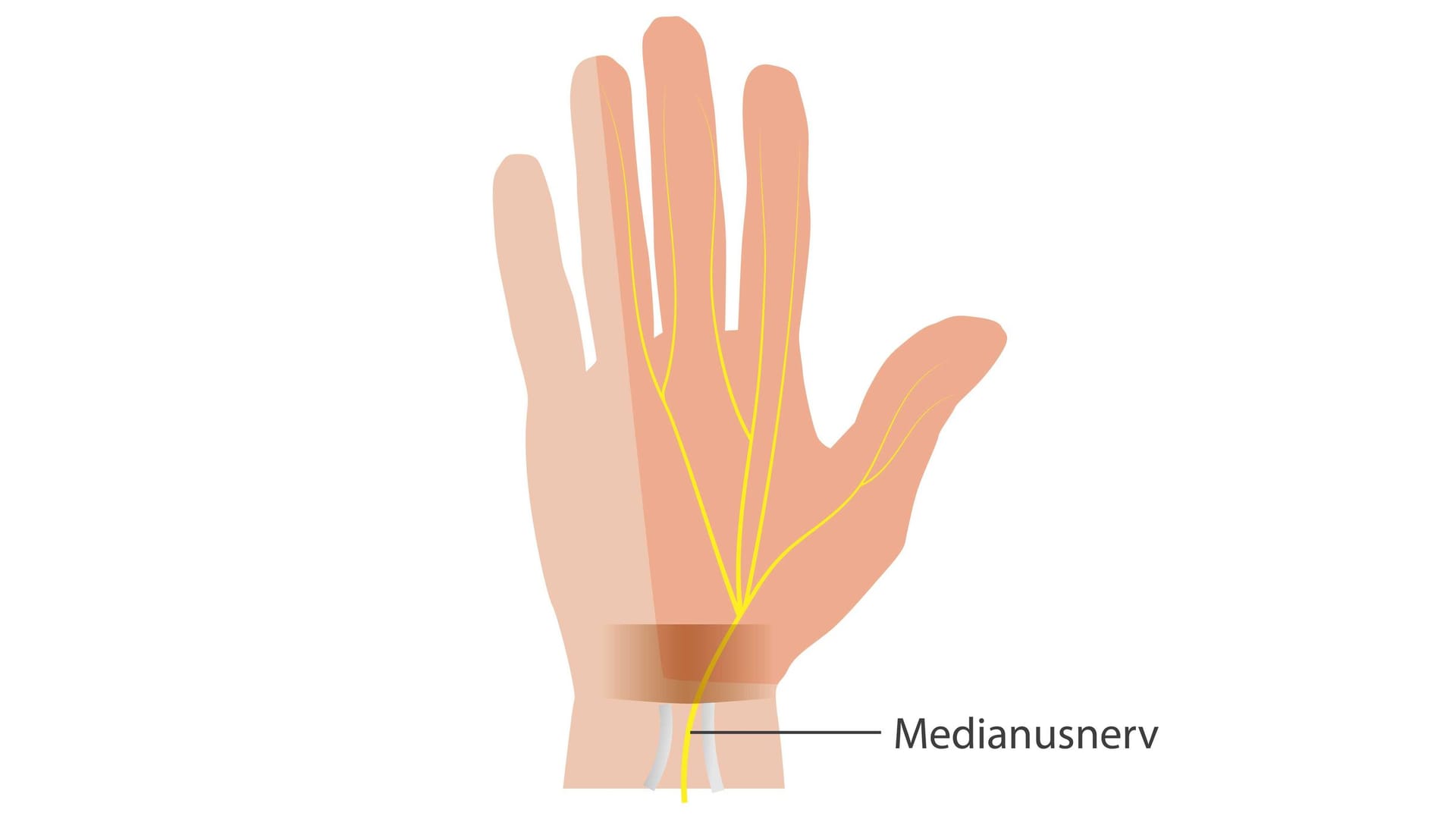 Illustration Medianusnerv: Im Handgelenk verläuft der Medianusnerv im Karpaltunnel.