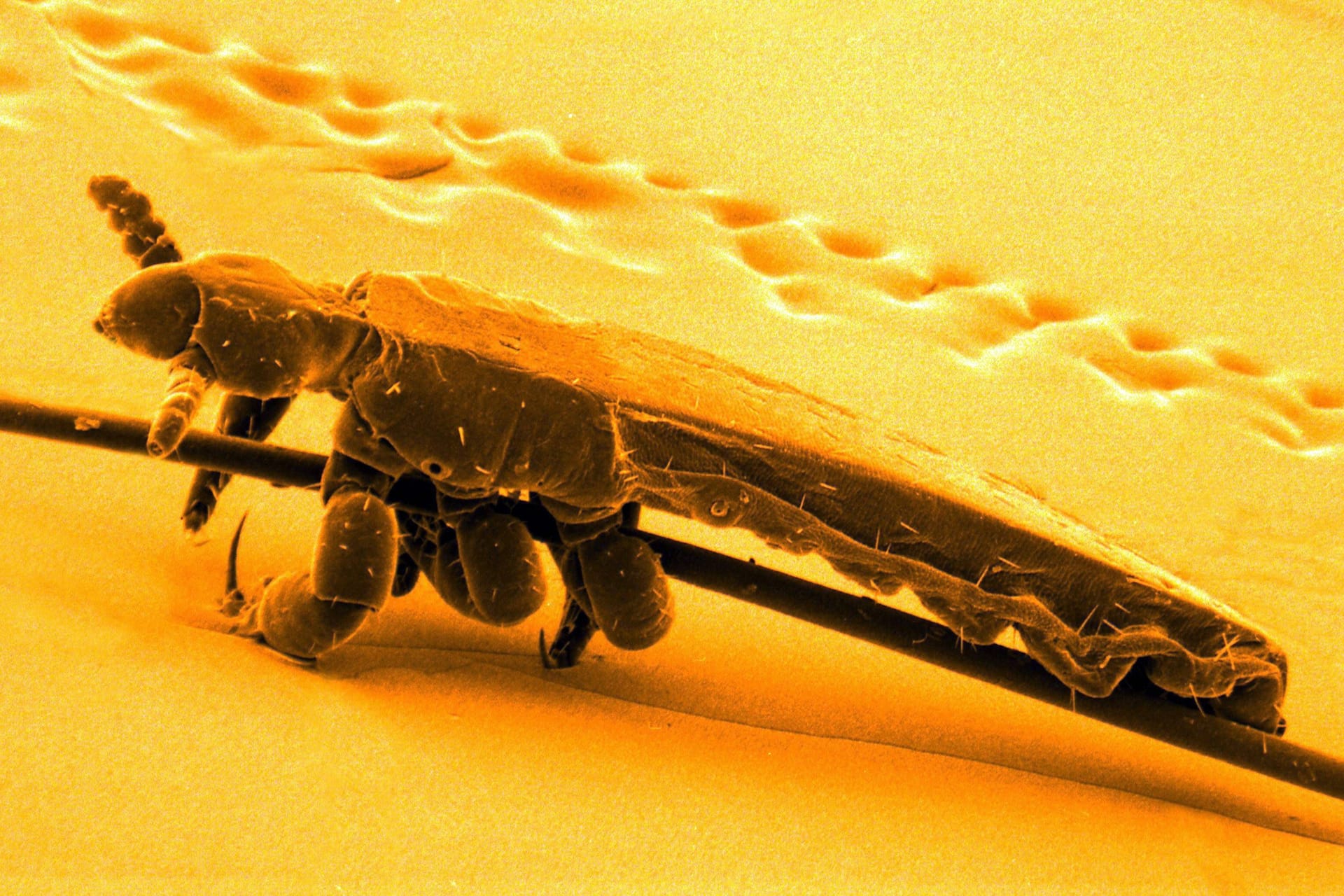 Elektronenmikroskopaufnahme einer Kopflaus (Symbolbild): Die kleinen, juckenden Tierchen breiten sich auf den Köpfen der Hamburger Kinder aus.