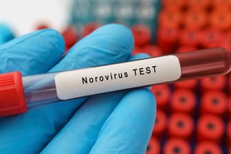 Eine Blutprobe wurde auf das Norovirus getestet (Symbolbild): In Köln steigen die Fälle der hochansteckenden Infektionskrankheit.
