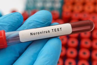 Eine Blutprobe wurde auf das Norovirus getestet (Symbolbild): In Köln steigen die Fälle der hochansteckenden Infektionskrankheit.